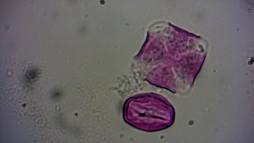 andere pollen te zien