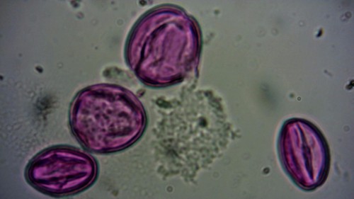 de meest voorkomende pollen uit dit klompje