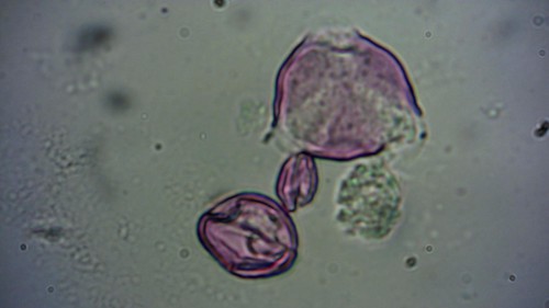 Ook hier een geheel andere pollen